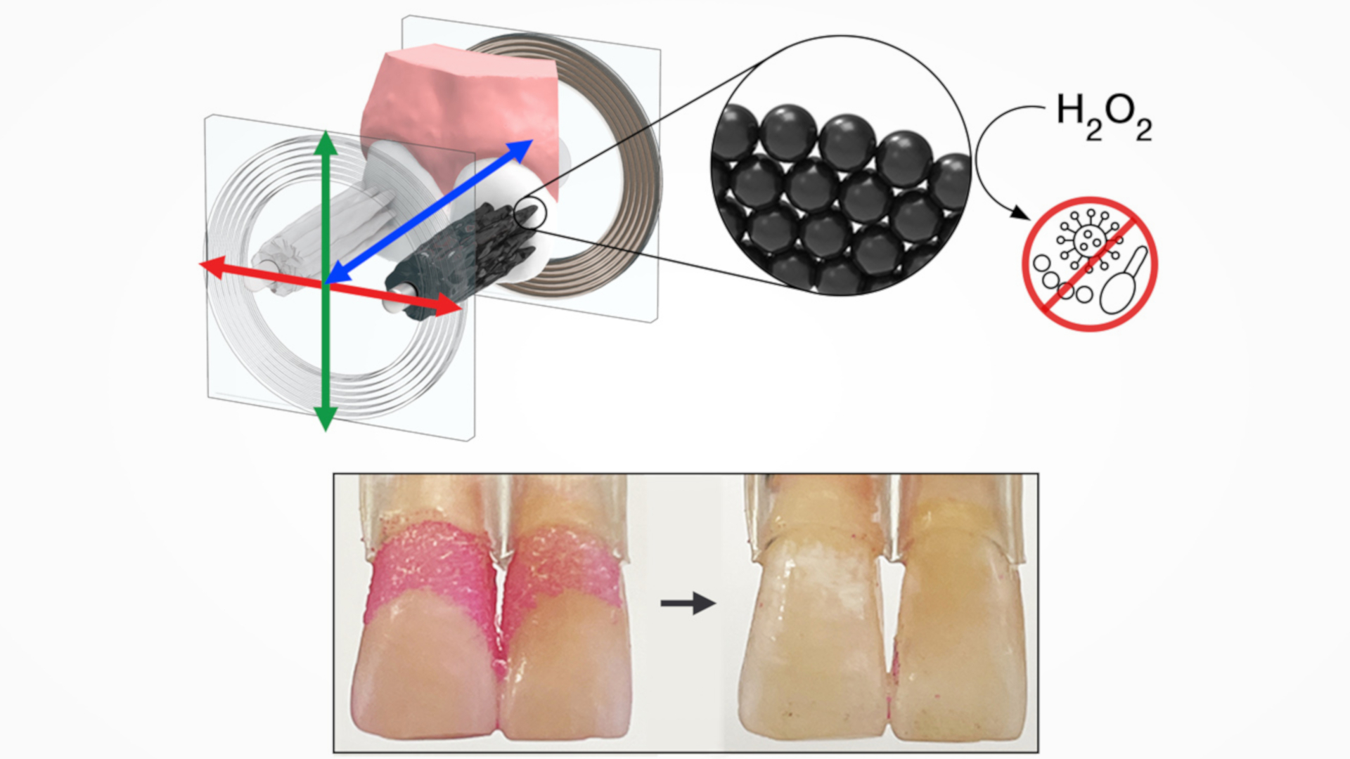 By forming hydroxyl radicals in the presence of hydrogen peroxide (H2O2), the nanoparticles, which also have magnetic properties, can effectively eliminate dental plaque. (Image: Min Jun Oh/Penn Dental Medicine)